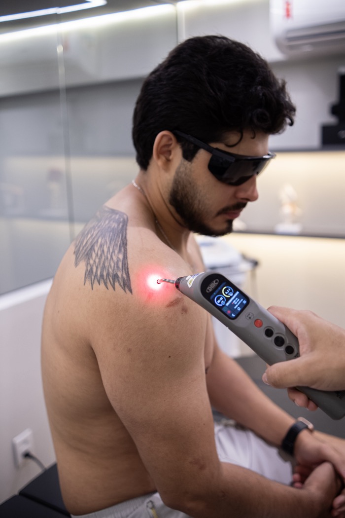 Laser de alta potência no Instituto Torque